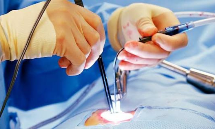 Laser Surgery